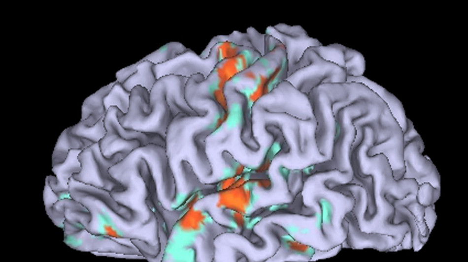 Le difficolt&agrave; economiche fanno invecchiare prima il cervello