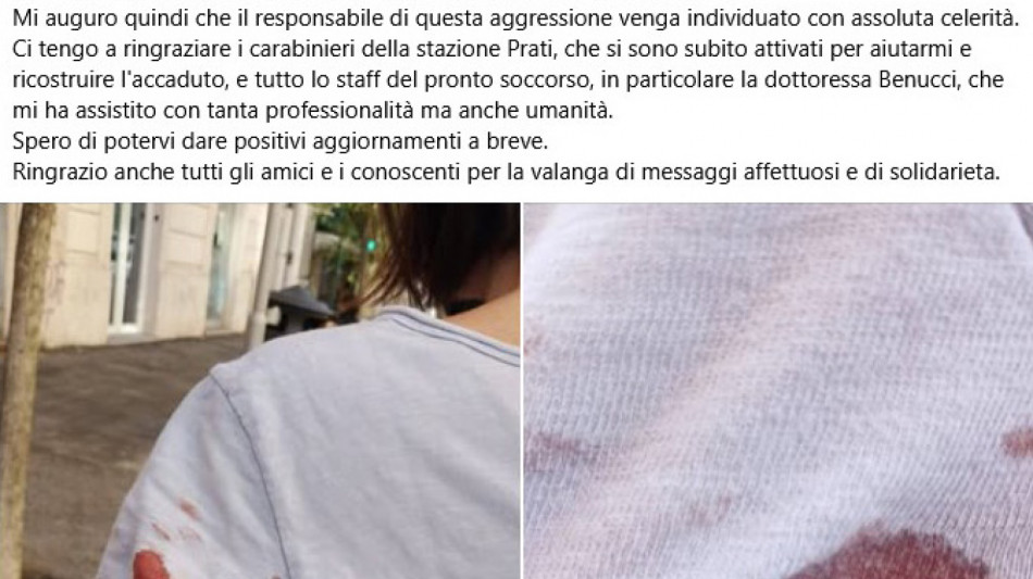Donna ferita da piombino a Roma, in caserma il presunto responsabile