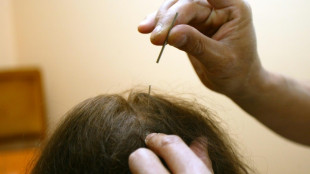 Arnaques, arrêt de soins, intoxications: la face sombre des "médecines douces"